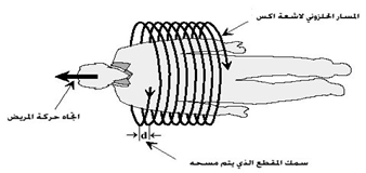 جهاز التصویر المقطعی CAT