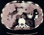 جهاز التصویر المقطعی CAT