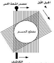 جهاز التصویر المقطعی CAT