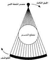 جهاز التصویر المقطعی CAT
