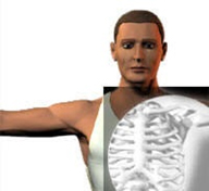  الأشعة السینیة