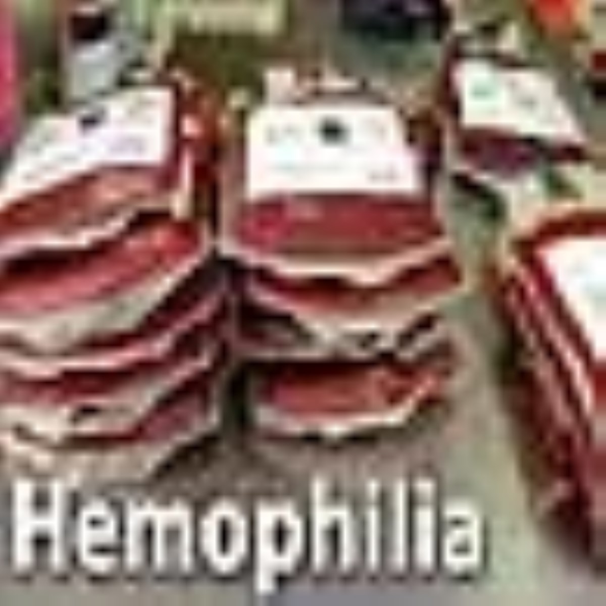 در کنارهم، مراقب هم - ویژه نامه روز جهانی هموفیلی