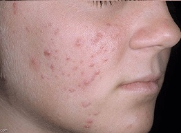  القدرة السحرية لزیت الخروع